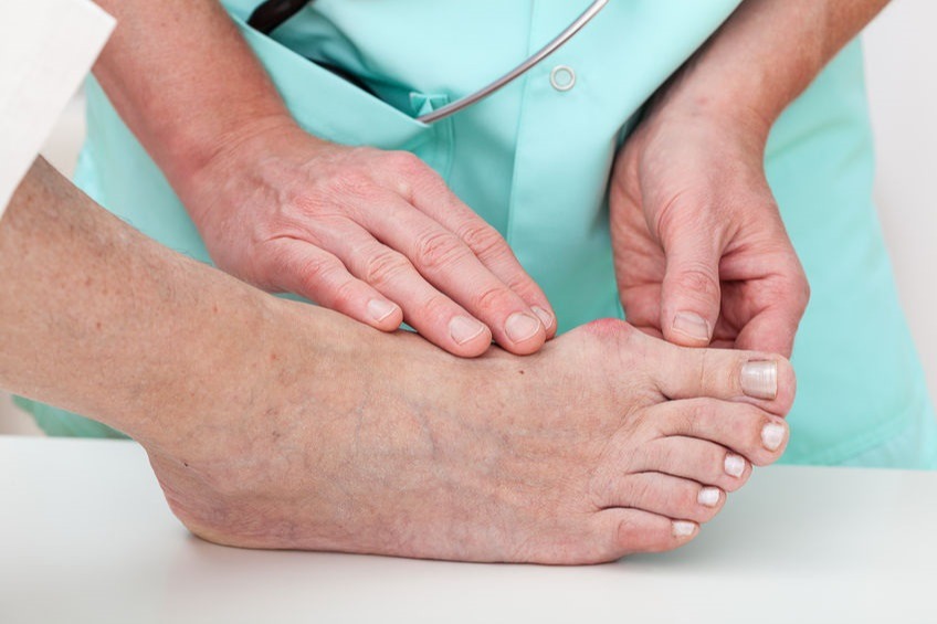 Professional Diabetic Foot Ulcer