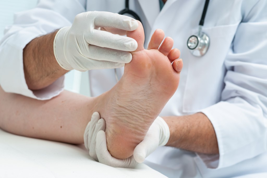 Diabetic Peripheral Neuropathy Treatment