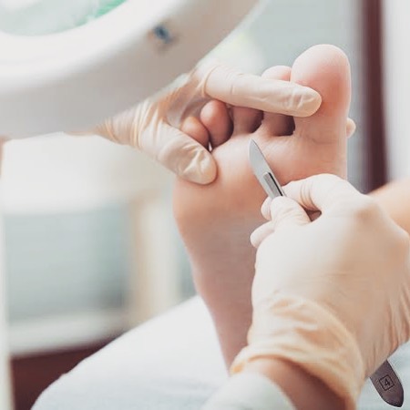 Diabetes Foot Treatment Near Winslow AZ