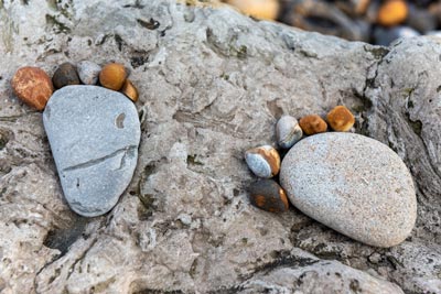 Flagstaff Foot Doctors | Flat Feet Treatment in Flagstaff, AZ